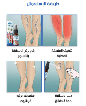 Varicose Veins Spray / بخاخ علاج الدوالي